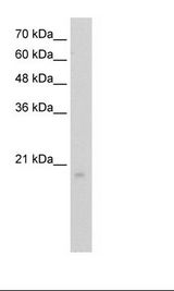 HepG2 Cell Lysate