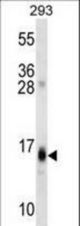 RGS8 Antibody western blot of 293 cell line lysates (35 ug/lane). The RGS8 antibody detected the RGS8 protein (arrow).