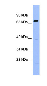RGS9 antibody LS-C107484 Western blot of Fetal Spleen lysate.