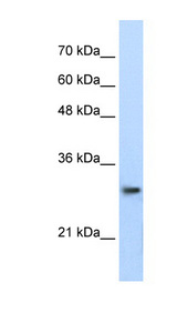 PSMA1 antibody LS-B1558 Western blot of Jurkat lysate.