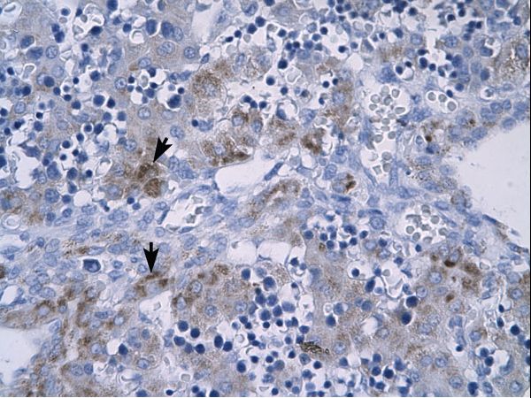 RGS9 antibody LS-C31056 was used in IHC to stain formalin-fixed, paraffin-embedded human liver.