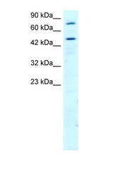 RGS9 antibody LS-C31056 Western blot of HepG2 Cell lysate. Antibody concentration 1 ug/ml.