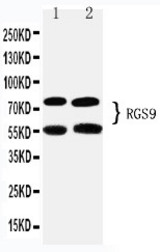 WB of RGS9 antibody. Lane 1: Rat Brain Tissue Lysate. Lane 2: Mouse Brain Tissue Lysate.
