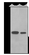 Western blot analysis on (A) PC-12 and (B) human spleen lysates using anti-RGS9 antibody.