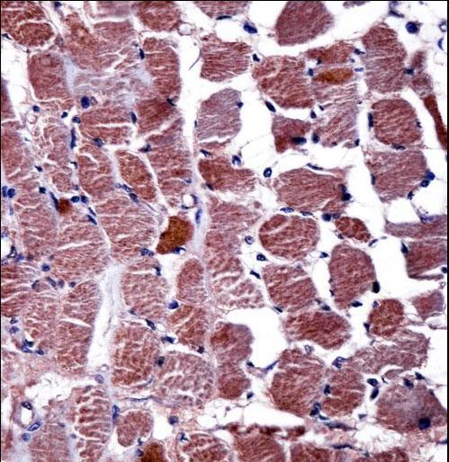 RGS9 Antibody immunohistochemistry of formalin-fixed and paraffin-embedded human skeletal muscle followed by peroxidase-conjugated secondary antibody and DAB staining.