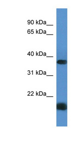 RHBDD1 antibody LS-C135809 Western blot of Fetal Kidney lysate.