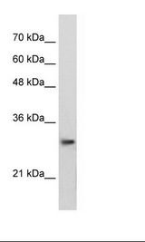 Jurkat Cell Lysate