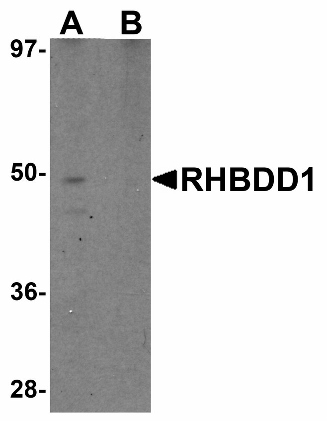 Western blot of RHBDD1 in K562 cell lysate with RHBDD1 antibody at 1 ug/ml in (A) the absence and (B) the presence of blocking peptide.