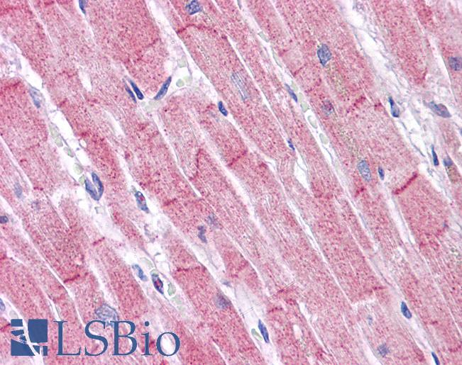 Anti-RHBDD3 antibody IHC of human heart. Immunohistochemistry of formalin-fixed, paraffin-embedded tissue after heat-induced antigen retrieval. Antibody LS-B5061 concentration 5 ug/ml.