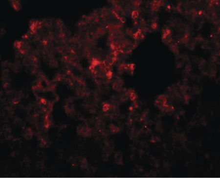 Immunofluorescence of RHBDD32 in rat lung tissue with RHBDD3 antibody at 20 ug/ml.