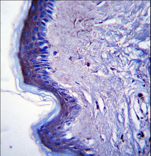 RHBDF2 Antibody immunohistochemistry of formalin-fixed and paraffin-embedded human skin tissue followed by peroxidase-conjugated secondary antibody and DAB staining.