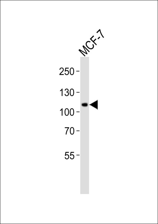 Western blot of lysate from MCF-7 cell line, using RHBDF2 Antibody. Antibody was diluted at 1:1000. A goat anti-rabbit IgG H&L (HRP) at 1:10000 dilution was used as the secondary antibody. Lysate at 20ug.