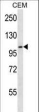 RHBDF2 Antibody western blot of CEM cell line lysates (35 ug/lane). The RHBDF2 antibody detected the RHBDF2 protein (arrow).