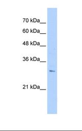 PANC1 cell lysate. Antibody concentration: 1.0 ug/ml. Gel concentration: 12%.