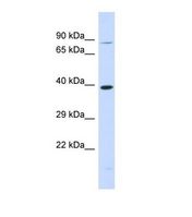 Western blot of Human 293T. RHBDL2 antibody dilution 1.0 ug/ml.