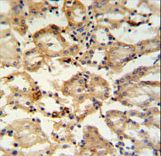 RHBG Antibody IHC of formalin-fixed and paraffin-embedded mouse kidney tissue followed by peroxidase-conjugated secondary antibody and DAB staining.