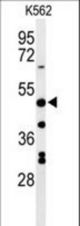 Western blot of RHBG Antibody in K562 cell line lysates (35 ug/lane). RHBG (arrow) was detected using the purified antibody.
