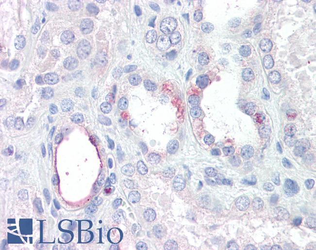 Anti-RHBG antibody IHC of human kidney. Immunohistochemistry of formalin-fixed, paraffin-embedded tissue after heat-induced antigen retrieval. Antibody LS-B7404 concentration 3.75 ug/ml.