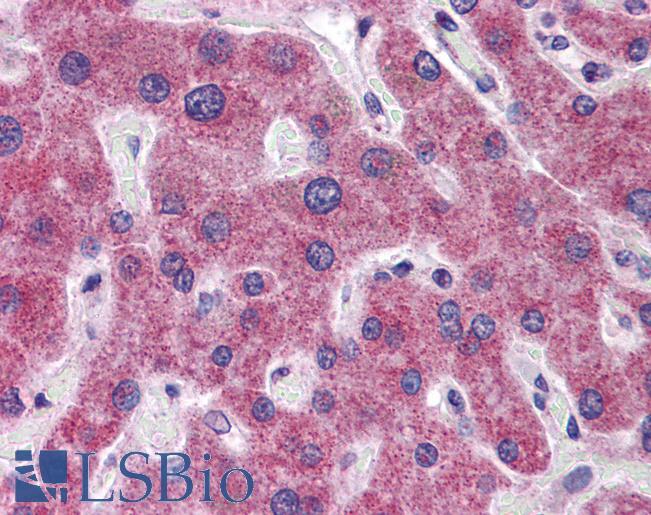 Anti-RHBG antibody IHC of human liver. Immunohistochemistry of formalin-fixed, paraffin-embedded tissue after heat-induced antigen retrieval. Antibody LS-B5816 concentration 5 ug/ml.