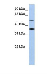 HepG2 cell lysate. Antibody concentration: 1.0 ug/ml. Gel concentration: 12%.