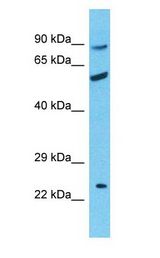 RHCE / RH antibody Western Blot of Uterus Tumor. Antibody dilution: 1 ug/ml.