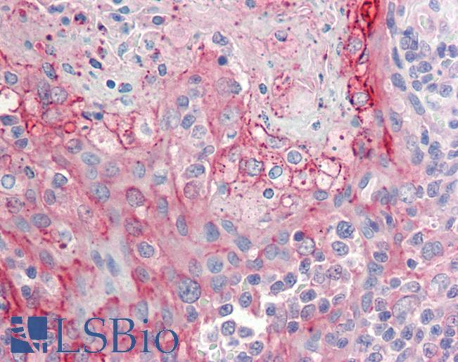 Anti-RHCG antibody IHC staining of human tonsil. Immunohistochemistry of formalin-fixed, paraffin-embedded tissue after heat-induced antigen retrieval.