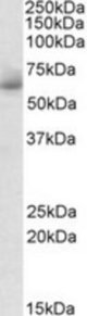 RHCG antibody (1 ug/ml) staining of Human Testis lysate (35 ug protein/ml in RIPA buffer). Primary incubation was 1 hour. Detected by chemiluminescence.