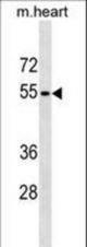 RHCG Antibody western blot of mouse heart tissue lysates (35 ug/lane). The RHCG antibody detected the RHCG protein (arrow).