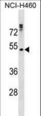 RHCG Antibody western blot of NCI-H460 cell line lysates (35 ug/lane). The RHCG antibody detected the RHCG protein (arrow).