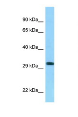 RHD antibody LS-C146162 Western blot of 8226 Cell lysate. Antibody concentration 1 ug/ml.