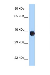 RHD antibody LS-C146065 Western blot of 293T Cell lysate. Antibody concentration 1 ug/ml.
