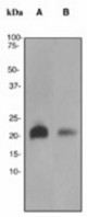 Western blot analysis on (A) Raji and (B) SH-SY5Y cell lysates using anti-Rheb antibody (LS-C105583), dilution 1:2000.