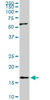 RHEB monoclonal antibody (M01), clone 2C11. Western blot of RHEB expression in PC-12.