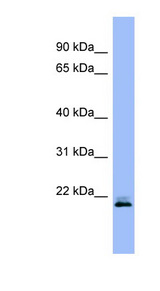 RHEB antibody western blot of Human fetal muscle lysate.