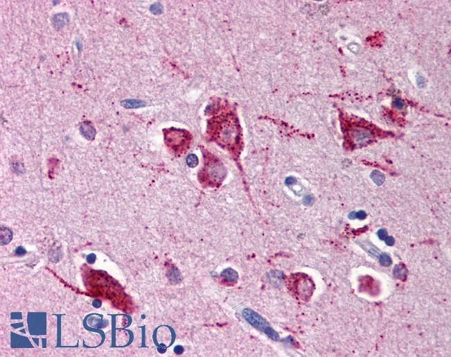 Anti-RHEB antibody IHC of human brain, cortex. Immunohistochemistry of formalin-fixed, paraffin-embedded tissue after heat-induced antigen retrieval. Antibody LS-B543 concentration 5 ug/ml.