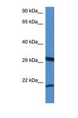 RHEBL1 antibody LS-C135286 Western blot of Mouse Kidney lysate. Antibody concentration 1 ug/ml.