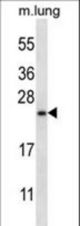 RHEBL1 Antibody western blot of mouse lung tissue lysates (35 ug/lane). The RHEBL1 antibody detected the RHEBL1 protein (arrow).