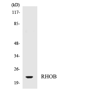 Western blot of the lysates from HepG2 cells using RHOB antibody.