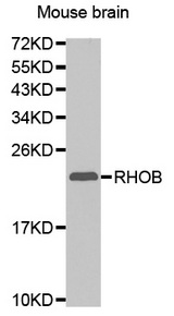 Western blot analysis of extracts of Mouse brain tissue, using RhoB antibody.