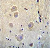 ARHB Antibody immunohistochemistry of formalin-fixed and paraffin-embedded human brain tissue followed by peroxidase-conjugated secondary antibody and DAB staining.