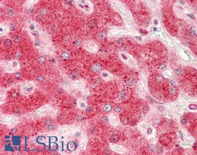 Human Liver: Formalin-Fixed, Paraffin-Embedded (FFPE)