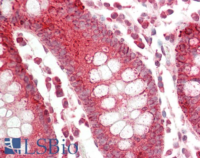 Human Colon: Formalin-Fixed, Paraffin-Embedded (FFPE)