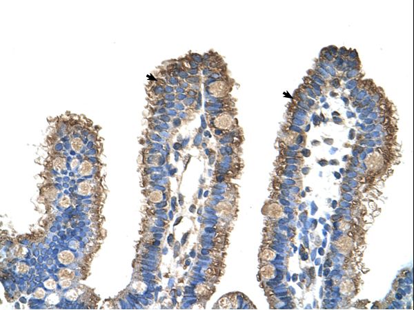 RHOBTB1 antibody LS-C30537 was used in IHC to stain formalin-fixed, paraffin-embedded human intestine.