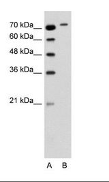 A: Marker, B: Jurkat Cell Lysate
