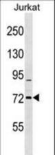 RHOBTB1 Antibody western blot of Jurkat cell line lysates (35 ug/lane). The RHOBTB1 antibody detected the RHOBTB1 protein (arrow).