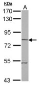 Sample (30 ug of whole cell lysate) A: A431 7.5% SDS PAGE RHOBTB1 antibody diluted at 1:5000