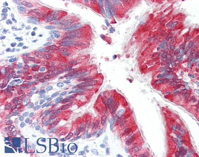 Anti-RHOBTB2 / DBC2 antibody IHC staining of human lung, respiratory epithelium. Immunohistochemistry of formalin-fixed, paraffin-embedded tissue after heat-induced antigen retrieval. Antibody LS-B10001 concentration 10 ug/ml.