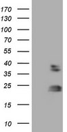 HEK293T cells were transfected with the pCMV6-ENTRY control (Left lane) or pCMV6-ENTRY RHOC (Right lane) cDNA for 48 hrs and lysed. Equivalent amounts of cell lysates (5 ug per lane) were separated by SDS-PAGE and immunoblotted with anti-RHOC.