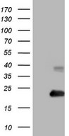 HEK293T cells were transfected with the pCMV6-ENTRY control (Left lane) or pCMV6-ENTRY RHOC (Right lane) cDNA for 48 hrs and lysed. Equivalent amounts of cell lysates (5 ug per lane) were separated by SDS-PAGE and immunoblotted with anti-RHOC.