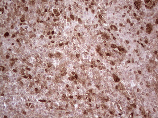 IHC of paraffin-embedded Human tonsil using anti-RHOC mouse monoclonal antibody. (Heat-induced epitope retrieval by 1 mM EDTA in 10mM Tris, pH8.5, 120°C for 3min).